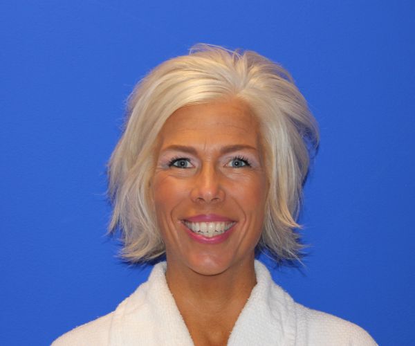 Botox Case 2746 UCI Plastic Surgery