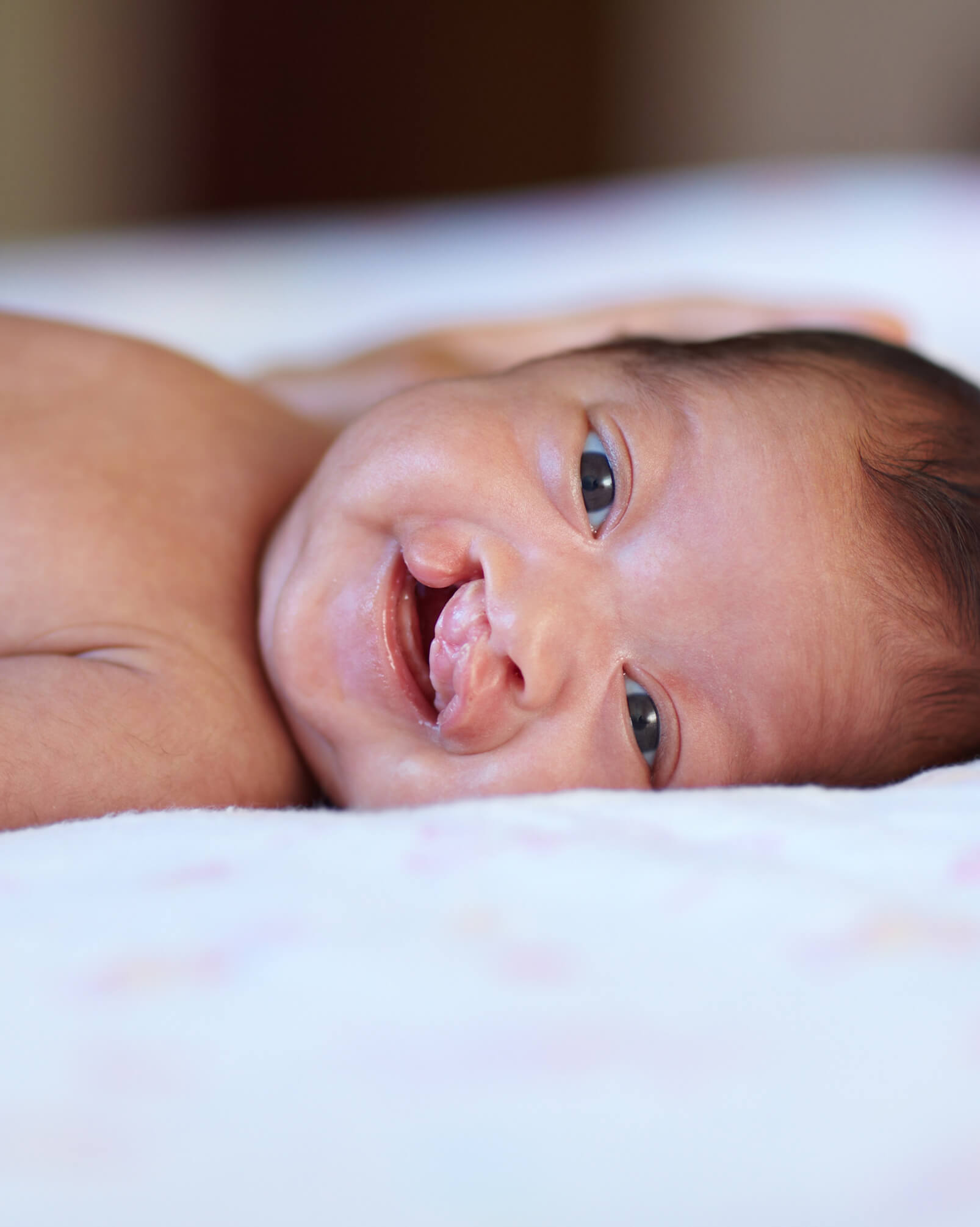 Baby with cleft lip palate