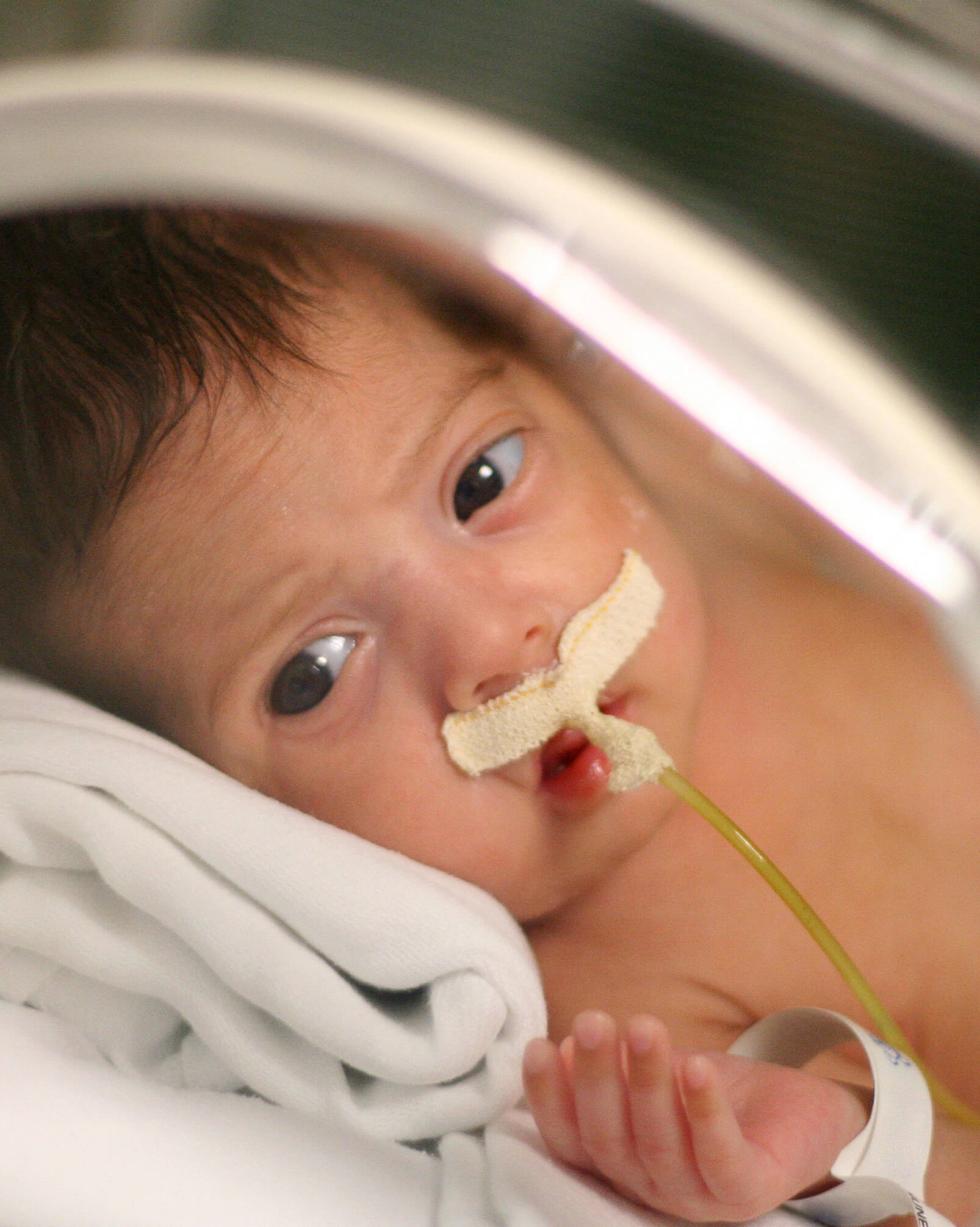 Premature baby recovering