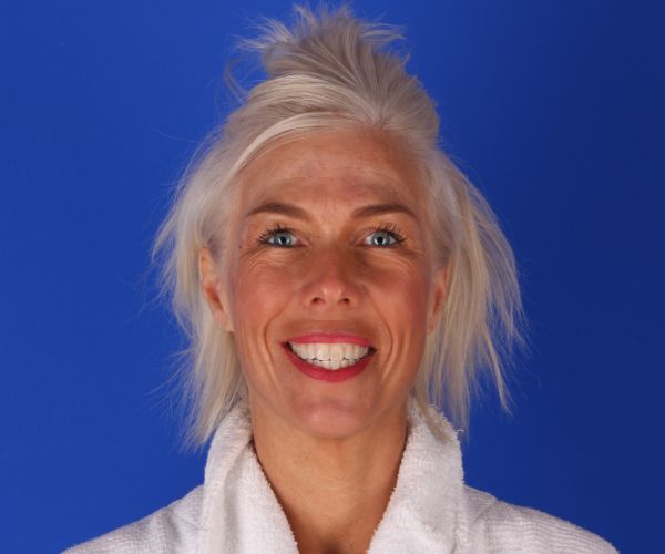 Case--2746 | Before Non-surgical