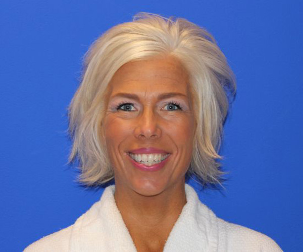 Case--2746 | After Non-surgical