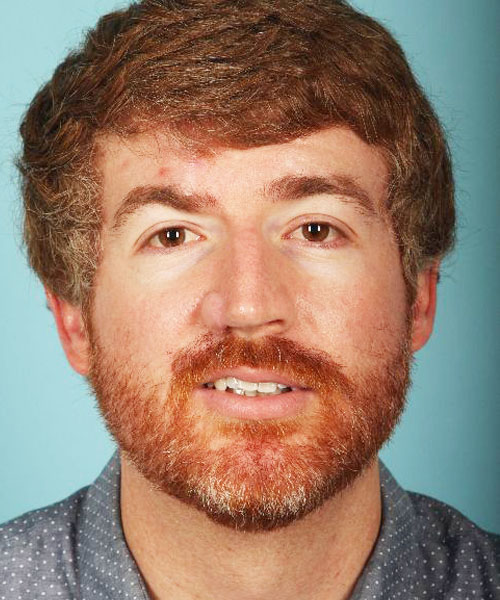 Case--3273 | Before Nasal Reconstruction